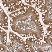 Anti-COPA antibody produced in rabbit Prestige Antibodies® Powered by Atlas Antibodies, affinity isolated antibody, buffered aqueous glycerol solution