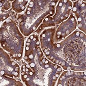 Anti-ATP6V0A2 antibody produced in rabbit Prestige Antibodies® Powered by Atlas Antibodies, affinity isolated antibody, buffered aqueous glycerol solution