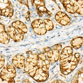 Anti-GCN2 Antibody, clone 1G2Z4, Rabbit Monoclonal