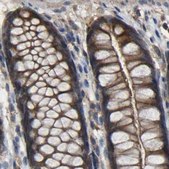 Anti-FHIT antibody produced in rabbit Prestige Antibodies® Powered by Atlas Antibodies, affinity isolated antibody, buffered aqueous glycerol solution