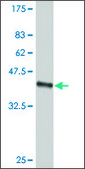ANTI-SMO antibody produced in mouse clone 2D10, purified immunoglobulin, buffered aqueous solution