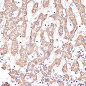 Anti-ATP5A1 antibody produced in rabbit