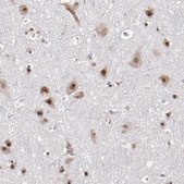 Anti-DDX24 antibody produced in rabbit Prestige Antibodies® Powered by Atlas Antibodies, affinity isolated antibody, buffered aqueous glycerol solution