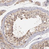 Anti-UPF3B antibody produced in rabbit Ab2, Prestige Antibodies® Powered by Atlas Antibodies, affinity isolated antibody, buffered aqueous glycerol solution