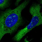 Anti-DYNC1I2 antibody produced in rabbit Prestige Antibodies® Powered by Atlas Antibodies, affinity isolated antibody, buffered aqueous glycerol solution