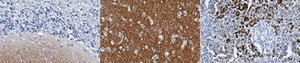 Anti-α-Synuclein Antibody, clone SOY1 clone SOY1, from mouse