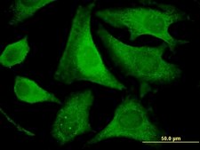 Monoclonal Anti-EIF2S2, (N-terminal) antibody produced in mouse clone 2F3, purified immunoglobulin, buffered aqueous solution