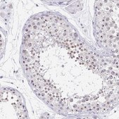 Anti-PAX3 antibody produced in rabbit Prestige Antibodies® Powered by Atlas Antibodies, affinity isolated antibody, buffered aqueous glycerol solution