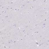Anti-GPR182 antibody produced in rabbit Prestige Antibodies® Powered by Atlas Antibodies, affinity isolated antibody, buffered aqueous glycerol solution