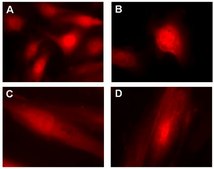 LentiBrite RFP-LC3 Control Mutant Lentiviral Biosensor