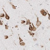 Anti-LRRC59 antibody produced in rabbit Prestige Antibodies® Powered by Atlas Antibodies, affinity isolated antibody, buffered aqueous glycerol solution