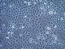 UFH-001 Human Breast Cancer Cell Line The UFH-001 triple negative CAIX+ human breast cancer cell line is suitable as a model for studying the mechanisms of triple negative breast cancer progression, metastasis and migration.
