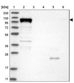 Anti-DHX36 antibody produced in rabbit Prestige Antibodies® Powered by Atlas Antibodies, affinity isolated antibody, buffered aqueous glycerol solution