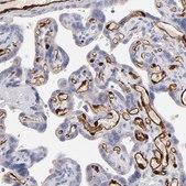 Anti-FABP4 antibody produced in rabbit Prestige Antibodies® Powered by Atlas Antibodies, affinity isolated antibody, buffered aqueous glycerol solution