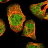 Anti-UBE2Z antibody produced in rabbit Prestige Antibodies® Powered by Atlas Antibodies, affinity isolated antibody, buffered aqueous glycerol solution