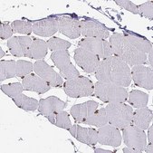 Anti-EMD antibody produced in rabbit Prestige Antibodies® Powered by Atlas Antibodies, affinity isolated antibody, buffered aqueous glycerol solution