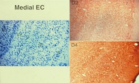 Anti-Dopamine D2 Receptor Antibody Chemicon®, from rabbit