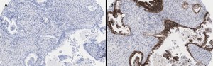 Anti-EpCAM Antibody, clone 1B8 , ZooMAb® Rabbit Monoclonal recombinant, expressed in HEK 293 cells