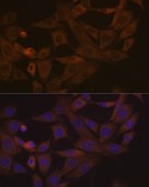Anti-Desmoglein 3 Antibody, clone 1T1D5, Rabbit Monoclonal
