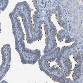 Anti-TTBK2 antibody produced in rabbit Prestige Antibodies® Powered by Atlas Antibodies, affinity isolated antibody, buffered aqueous glycerol solution