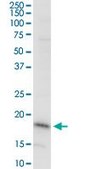 Monoclonal Anti-DAZAP2 antibody produced in mouse clone 8G5, purified immunoglobulin