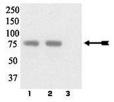 Anticuerpo anti-fosfo-LIMK 1/2 (Tyr507/Thr508) Upstate&#174;, from rabbit