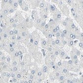 Anti-ZBTB7B antibody produced in rabbit Prestige Antibodies® Powered by Atlas Antibodies, affinity isolated antibody, buffered aqueous glycerol solution, Ab1