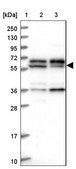 Anti-C15orf52 antibody produced in rabbit Prestige Antibodies® Powered by Atlas Antibodies, affinity isolated antibody, buffered aqueous glycerol solution