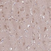 Anti-USP32 antibody produced in rabbit Prestige Antibodies® Powered by Atlas Antibodies, affinity isolated antibody, buffered aqueous glycerol solution