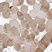 Anti-FASTK antibody produced in rabbit Prestige Antibodies® Powered by Atlas Antibodies, affinity isolated antibody, buffered aqueous glycerol solution