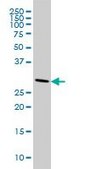 Monoclonal Anti-CNOT7 antibody produced in mouse clone 2F6, purified immunoglobulin, buffered aqueous solution