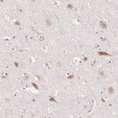 Anti-C14orf37 antibody produced in rabbit Prestige Antibodies® Powered by Atlas Antibodies, affinity isolated antibody, buffered aqueous glycerol solution