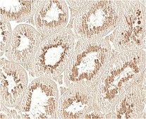 Anti-GPx4 Antibody, clone 1B4 clone 1B4, from rat