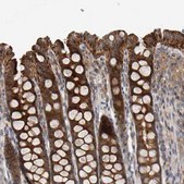 Anti-C9orf72 antibody produced in rabbit Prestige Antibodies® Powered by Atlas Antibodies, affinity isolated antibody, buffered aqueous glycerol solution