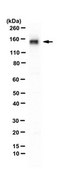 Anti-SMARCA5 Antibody from rabbit, purified by affinity chromatography