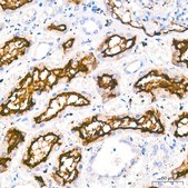 Anti-ACE2 Antibody, clone 5X5W10, Rabbit Monoclonal