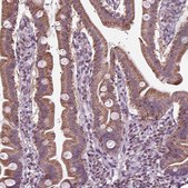Anti-SLC22A18AS antibody produced in rabbit Prestige Antibodies® Powered by Atlas Antibodies, affinity isolated antibody, buffered aqueous glycerol solution