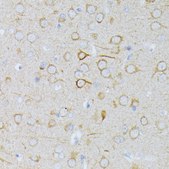 Anti-MAP2K1 antibody produced in rabbit
