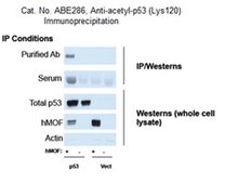 Anti-acetyl-p53 (Lys120) Antibody from rabbit, purified by affinity chromatography