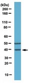 Anti-SRp30a (SF2) Antibody from rabbit