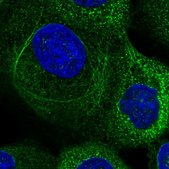 Anti-CMTM6 antibody produced in rabbit Prestige Antibodies® Powered by Atlas Antibodies, affinity isolated antibody, buffered aqueous glycerol solution