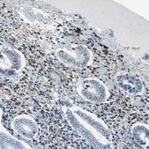 Anti-ECD antibody produced in rabbit Prestige Antibodies® Powered by Atlas Antibodies, affinity isolated antibody, buffered aqueous glycerol solution