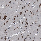 Anti-NMT1 antibody produced in rabbit Prestige Antibodies® Powered by Atlas Antibodies, affinity isolated antibody, buffered aqueous glycerol solution, Ab2