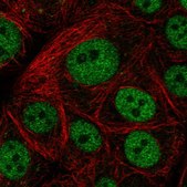 Anti-GTF3C5 antibody produced in rabbit Prestige Antibodies® Powered by Atlas Antibodies, affinity isolated antibody
