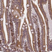 Anti-MTDH antibody produced in rabbit Ab1, Prestige Antibodies® Powered by Atlas Antibodies, affinity isolated antibody, buffered aqueous glycerol solution