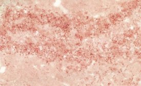 Anti-Synuclein Antibody, pan serum, Chemicon®