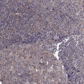 Anti-ARFGAP1 antibody produced in rabbit Prestige Antibodies® Powered by Atlas Antibodies, affinity isolated antibody, buffered aqueous glycerol solution