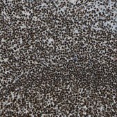 Anti-UBTF antibody produced in rabbit Prestige Antibodies® Powered by Atlas Antibodies, affinity isolated antibody, buffered aqueous glycerol solution