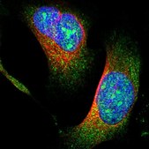 Anti-TRIM68 antibody produced in rabbit Prestige Antibodies® Powered by Atlas Antibodies, affinity isolated antibody, buffered aqueous glycerol solution