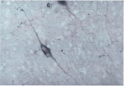 Anti-Dopamine β Hydroxylase Antibody serum, Chemicon®
